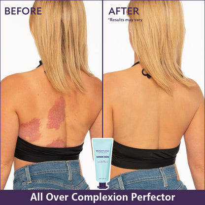 🔥 Last Day Discount: 80% OFF 🌸All Over Complexion Perfector