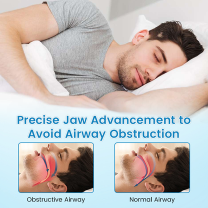✨[Official Store] JEREMYTIS™ Anti-Snoring & Anti-Grinding Teeth Protector